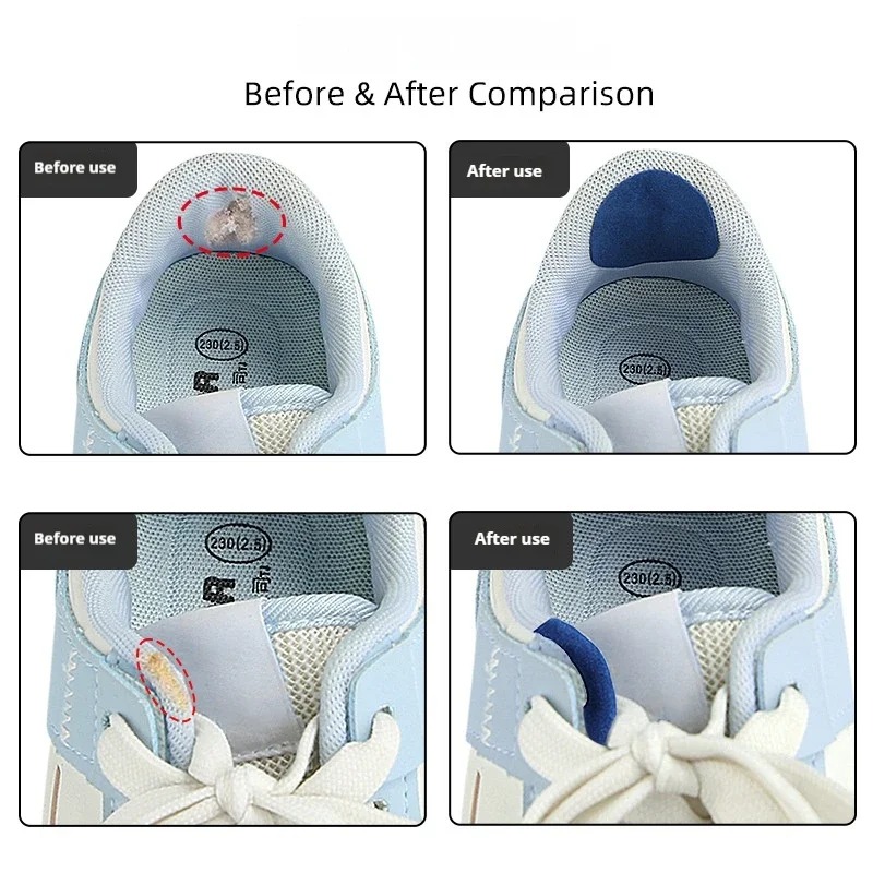 6 Peças Adesivos Protetores An - Sneaker Care Service avaliação e preço